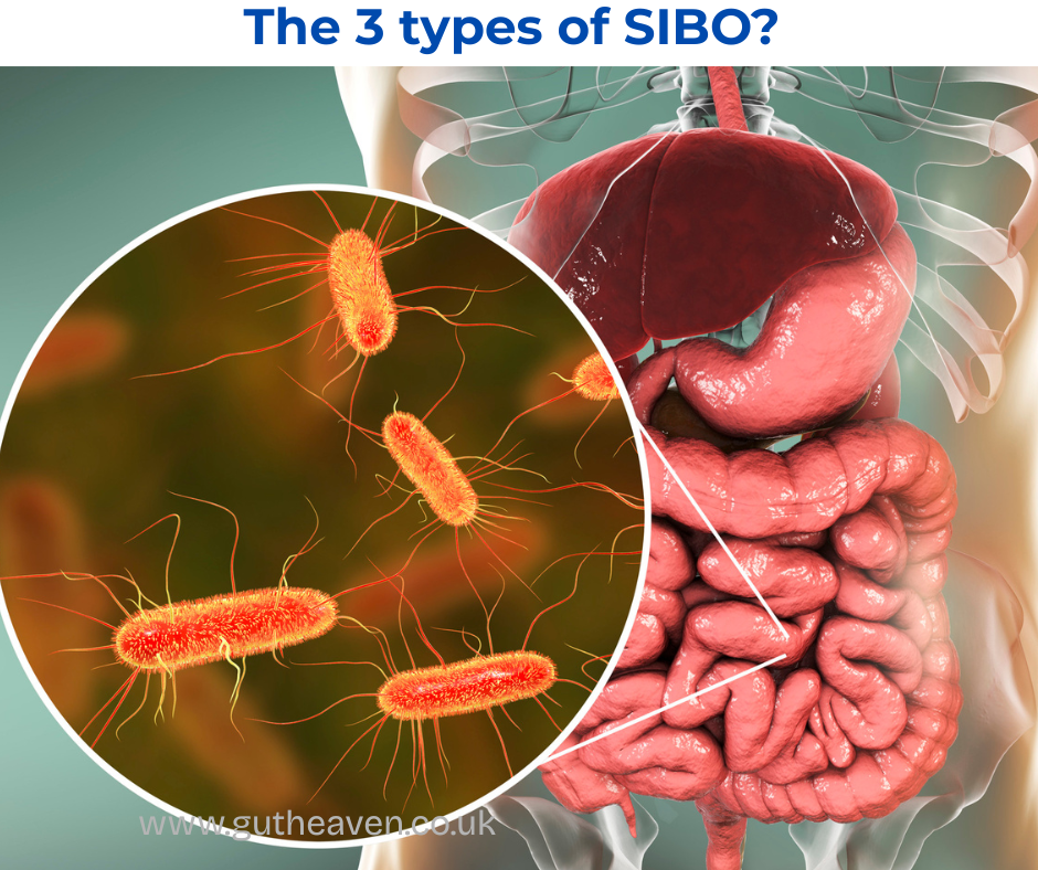 The 3 types of SIBO - Hydrogen, Methane & Hydrogen Sulphide
